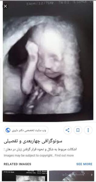 عکس صورت جنین در سونوگرافی نی نی سایت