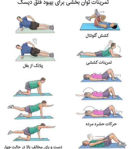 عکس ام ار ای دیسک خفیف