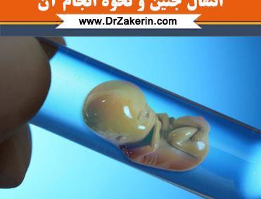 عکس کاشت جنین در رحم