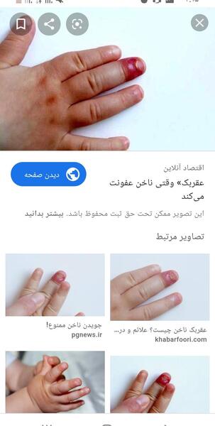 عکس ناخن خوردن