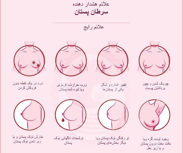 عکس غدد مونتگومری نی نی سایت