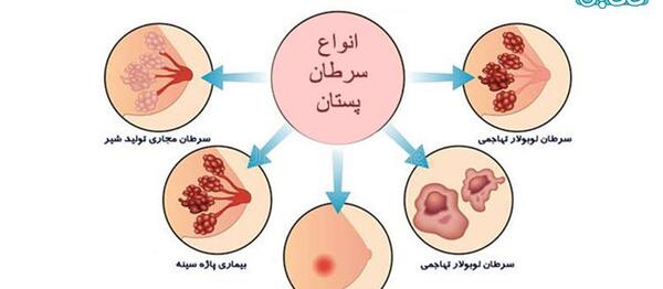 عکس غدد مونتگومری نی نی سایت