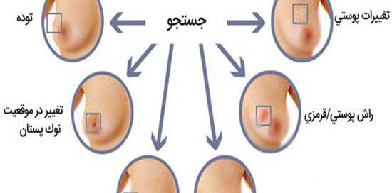 عکس غدد مونتگومری نی نی سایت