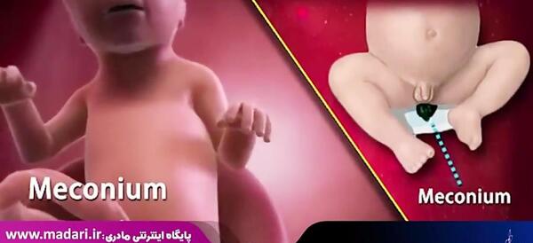 عکس جنین پسر در 20 هفتگی