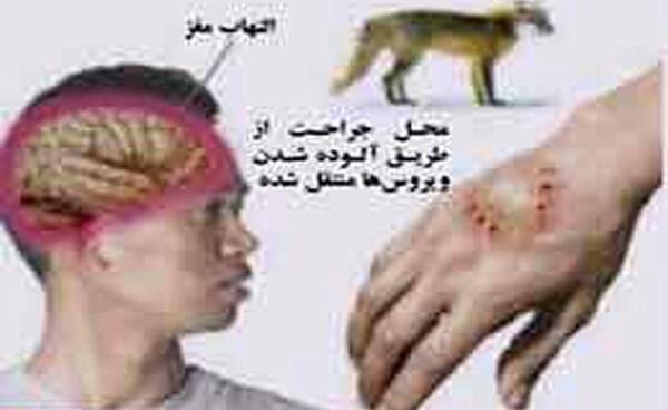 عکس ویروس هاری