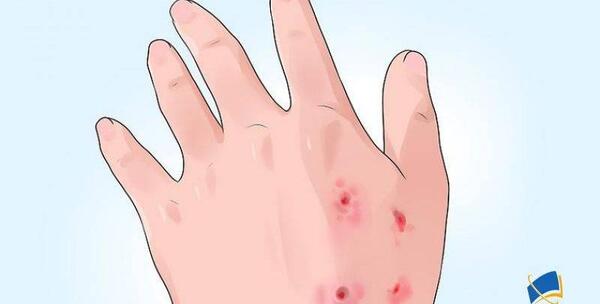 عکس ویروس هاری