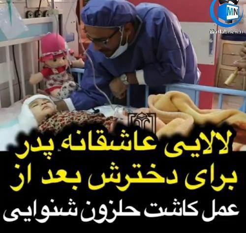 عکس کاشت حلزون