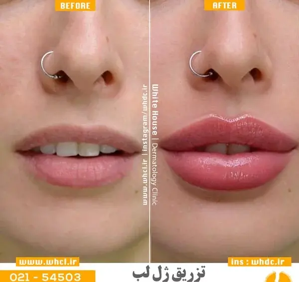 عکس لب طبیعی