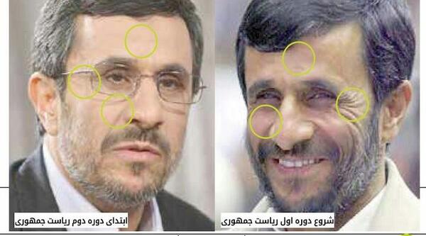 عکس قبل بوتاکس و بعد بوتاکس محسن رضایی