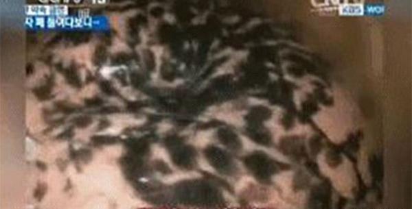 عکس ریه فرد قلیانی