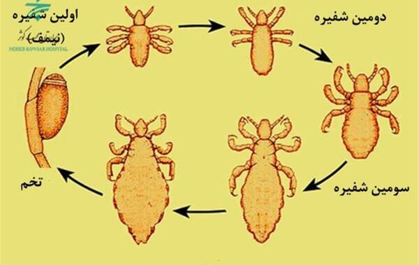 عکس بچه ی شپش