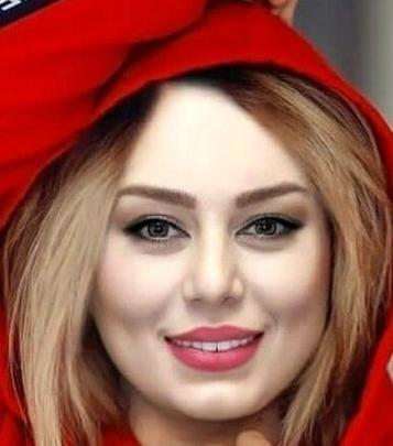 عکس لب پروتز زشت