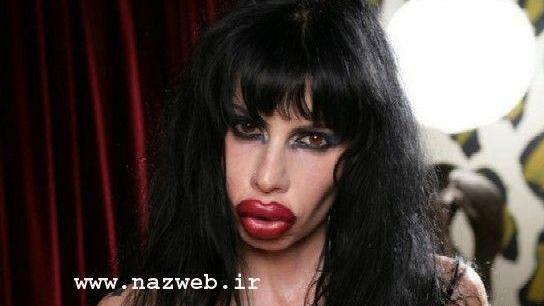 عکس لب پروتز زشت