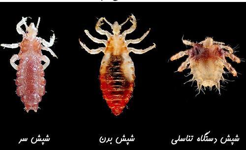 عکس شپش مشکی