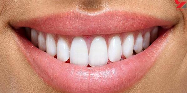 عکس های وحشتناک لب شکری