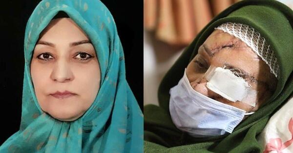 عکس چاقو کشی وحشتناک