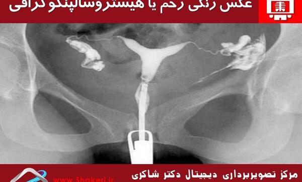بهترین عکس رنگی رحم در مشهد