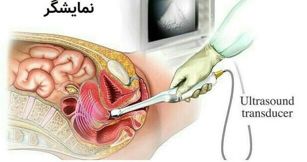 بهترین عکس رنگی رحم در مشهد