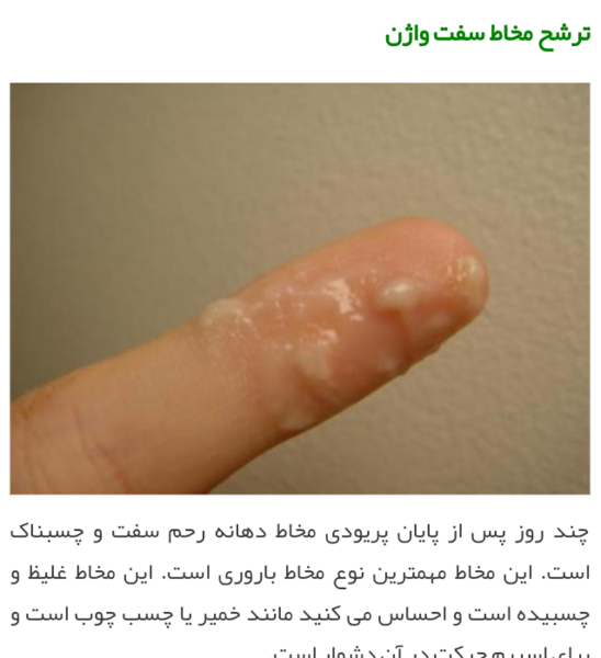 عکس ترشحات بارداری نی نی سایت
