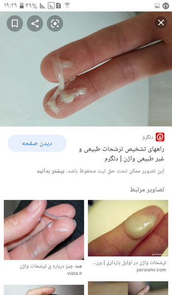 عکس ترشحات بارداری نی نی سایت