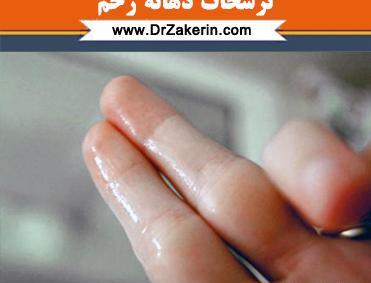عکس ترشحات بارداری نی نی سایت