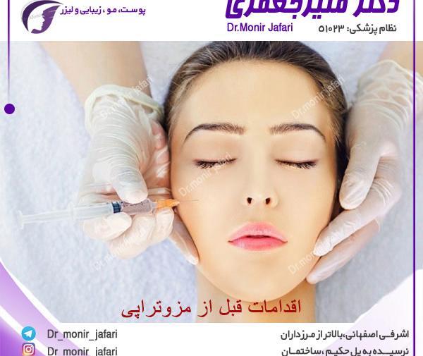 عکس قبل و بعد مزوتراپی صورت