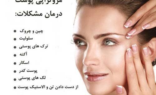 عکس قبل و بعد مزوتراپی صورت