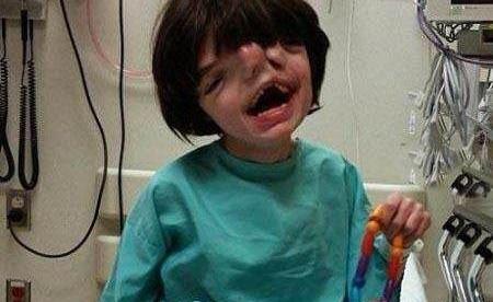 عکس وحشتناک برای بچه