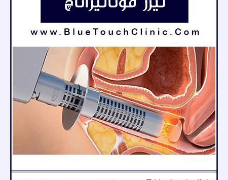 عکس لیزر مونالیزا تاچ