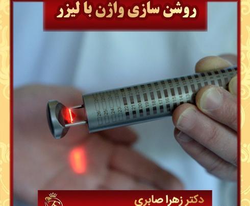 عکس لیزر مونالیزا تاچ
