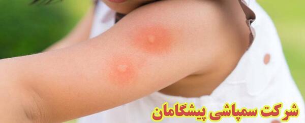 عکس نیش کنه