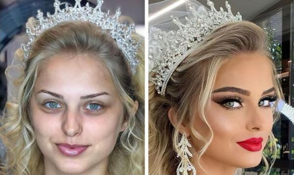 عکس قبل و بعد ارایش