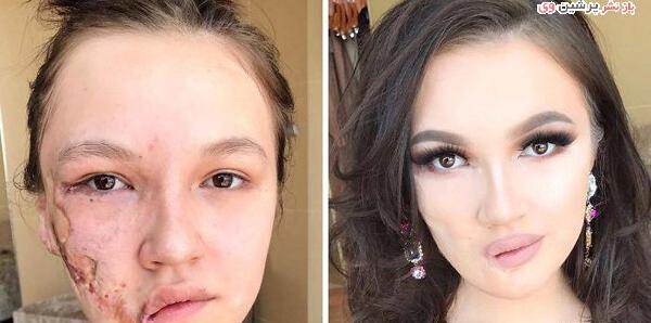 عکس قبل و بعد ارایش