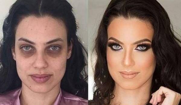 عکس قبل و بعد ارایش