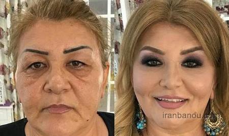 عکس قبل و بعد ارایش