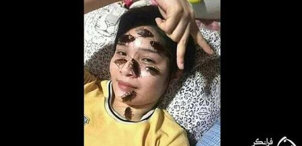 عکس سوسک چندش آور