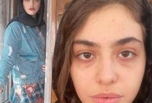 عکس وحشتناک ریحانه پارسا قبل از ترک ایران