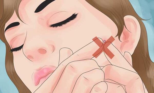 عکس کارتونی جوش صورت