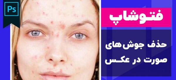عکس کارتونی جوش صورت
