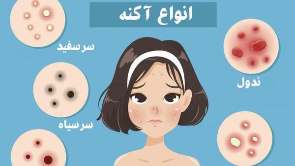 عکس کارتونی جوش صورت