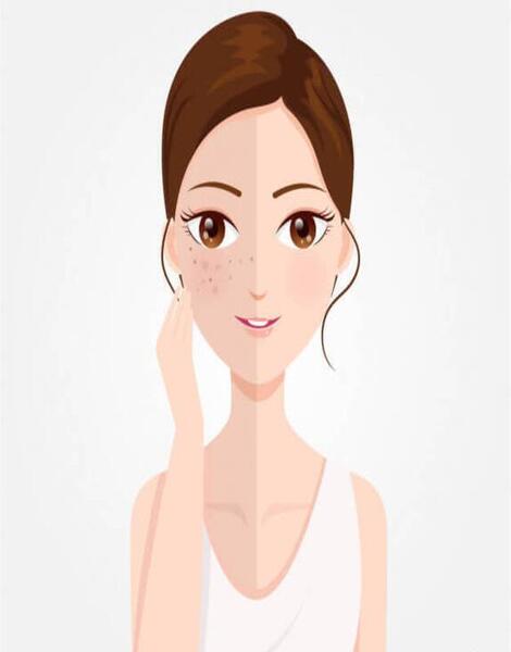 عکس کارتونی جوش صورت