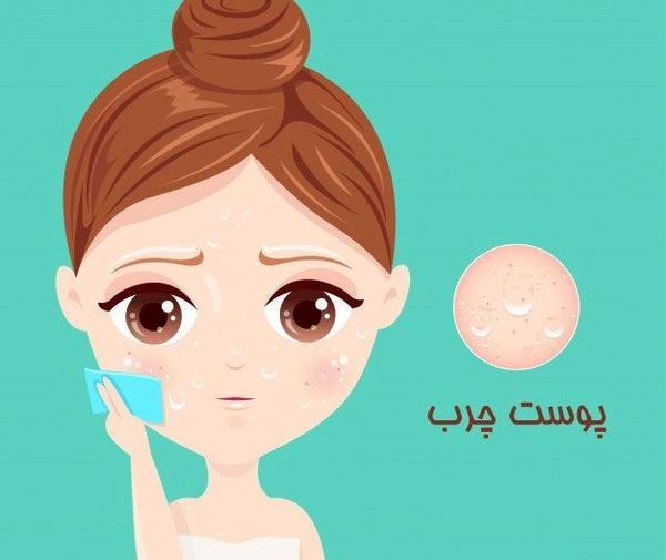 عکس کارتونی جوش صورت