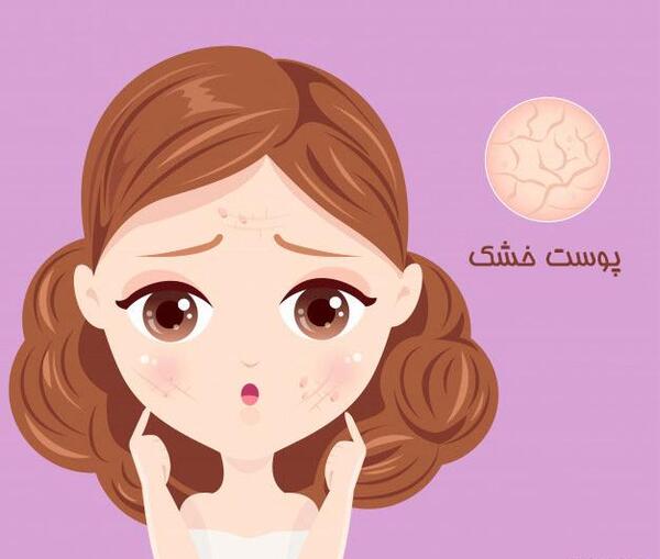 عکس کارتونی جوش صورت