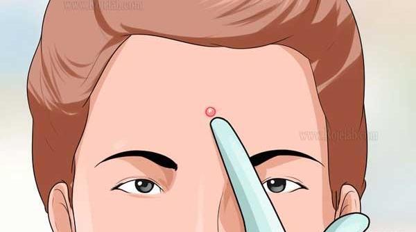 عکس کارتونی جوش صورت