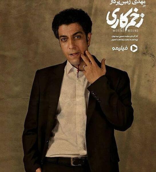 عکس بازیگر طلوعی در زخم کاری