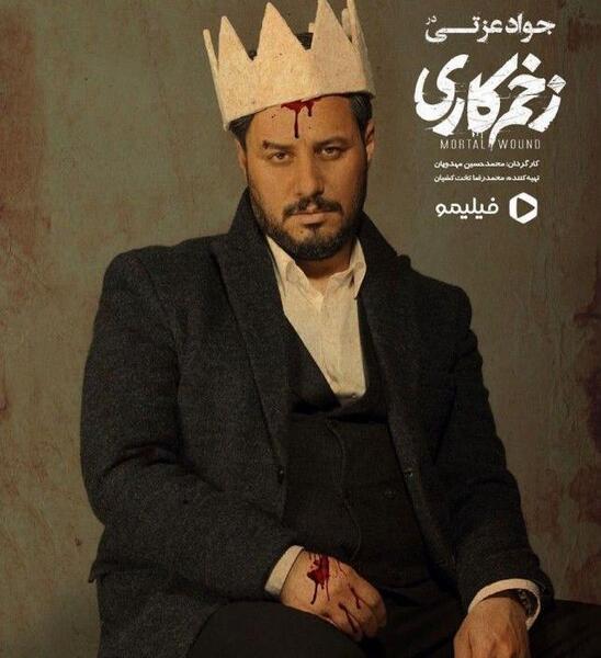 عکس بازیگر طلوعی در زخم کاری