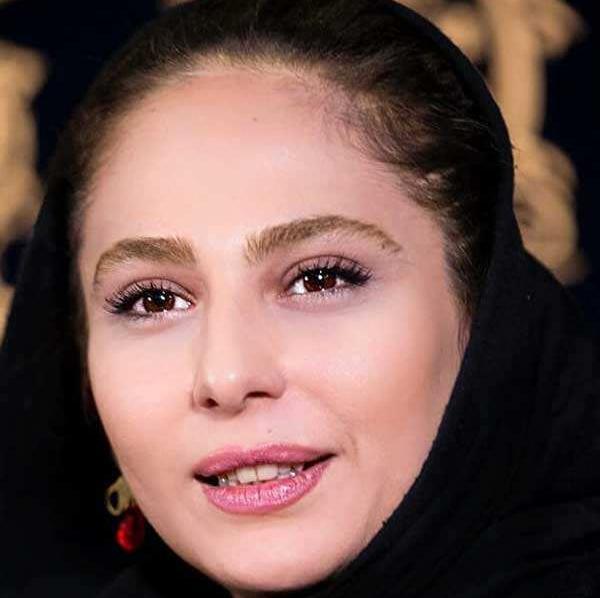 عکس بازیگر طلوعی در زخم کاری
