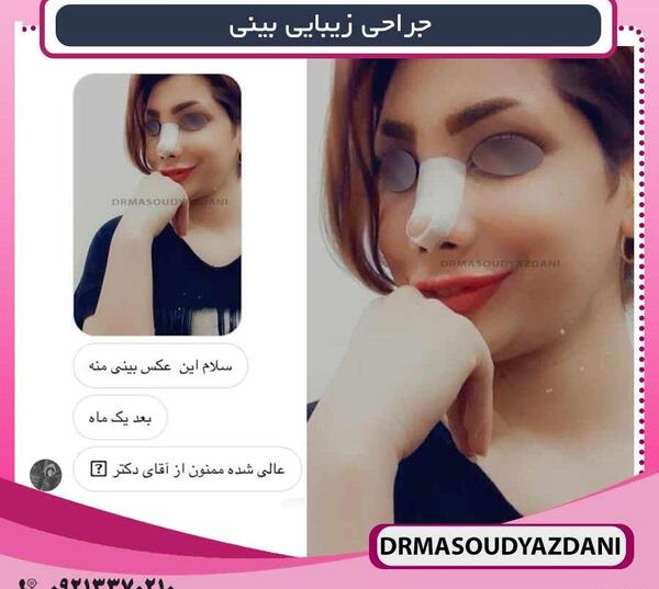 عکس کیک دماغ عملی