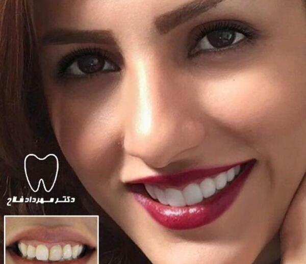 عکس چهره لبخند