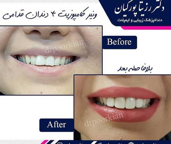 عکس طرح لبخند